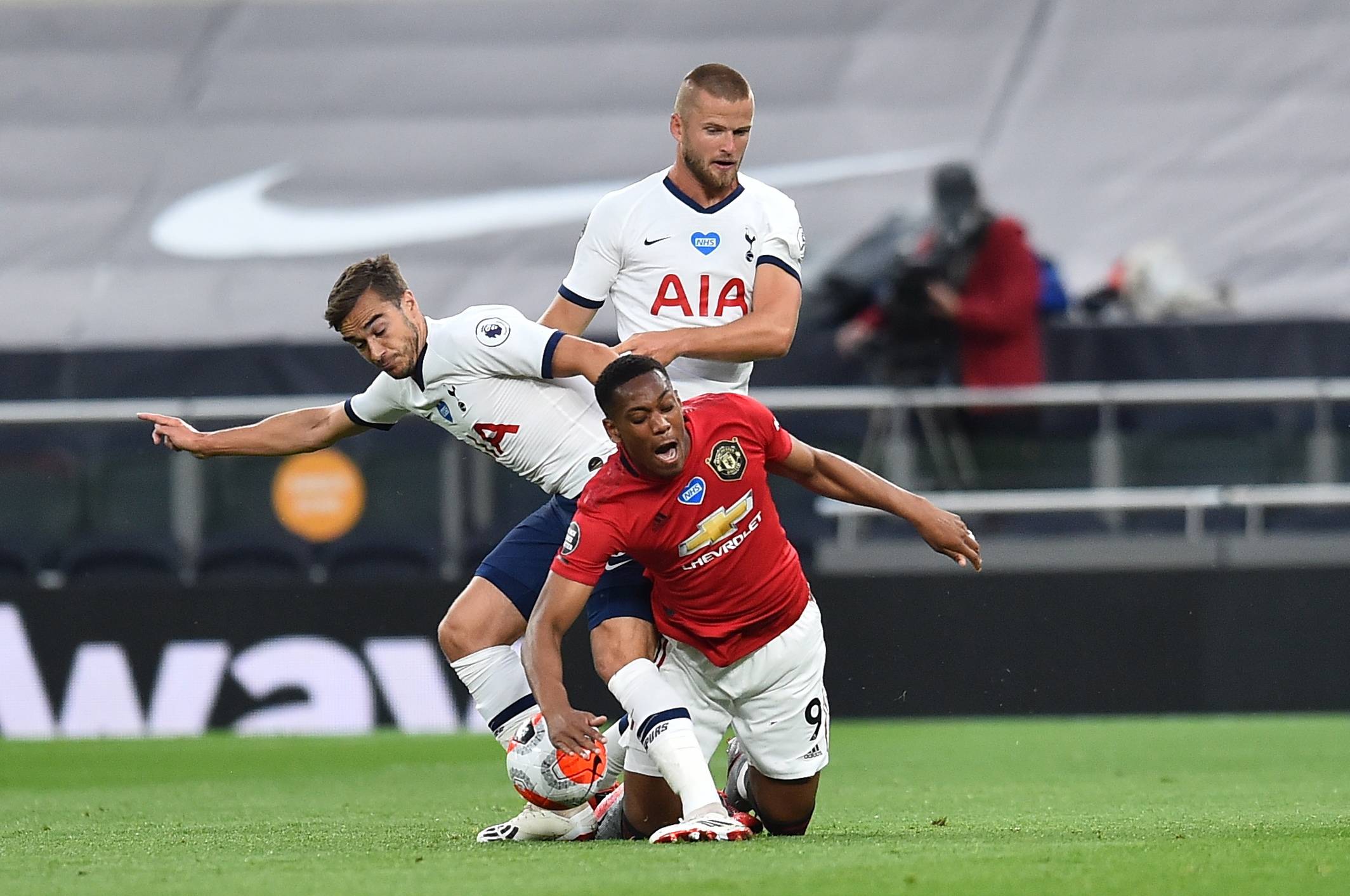 成本失真 成本失真